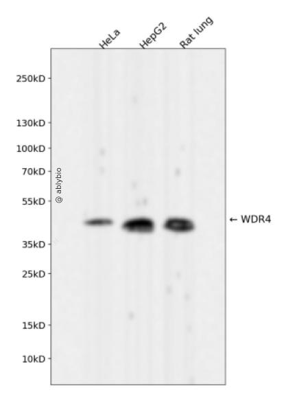 WDR4 Rabbit mAb