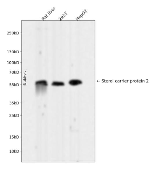 Sterol carrier protein 2 Rabbit mAb