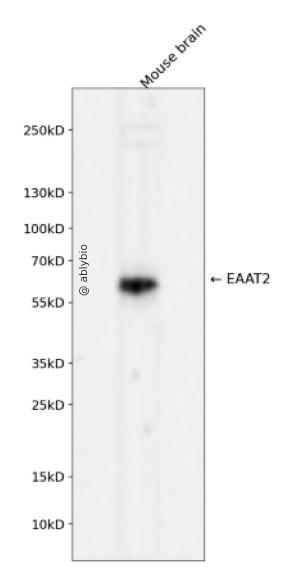 EAAT2 Rabbit mAb