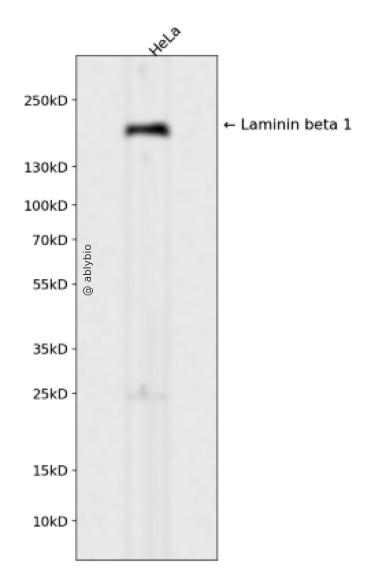 Laminin beta 1 Rabbit mAb