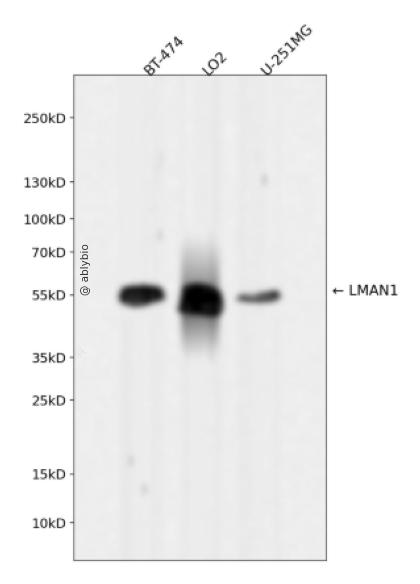 LMAN1 Rabbit mAb