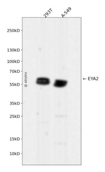 EYA2 Rabbit mAb