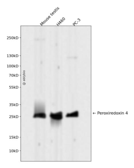 Peroxiredoxin 4 Rabbit mAb