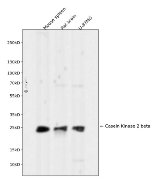 Casein Kinase 2 beta Rabbit mAb