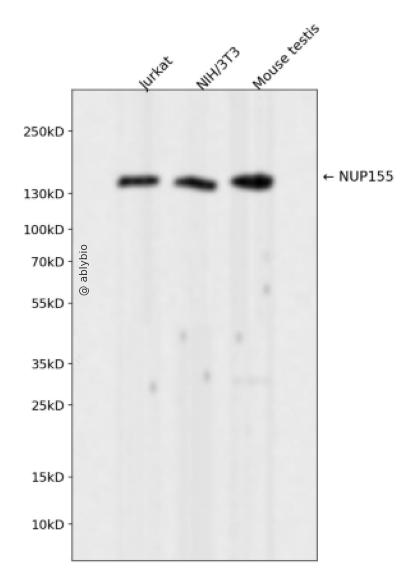 NUP155 Rabbit mAb
