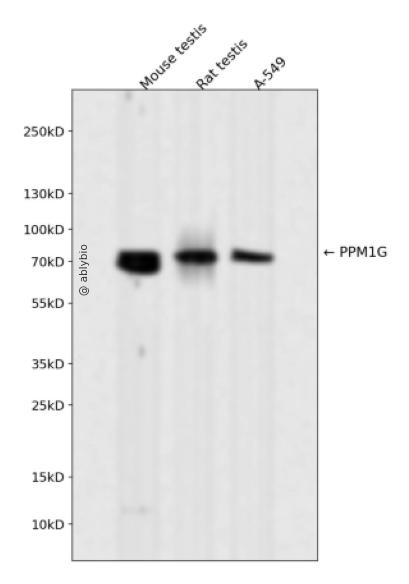 PPM1G Rabbit mAb