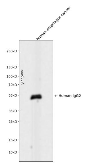 Human IgG2 Rabbit mAb