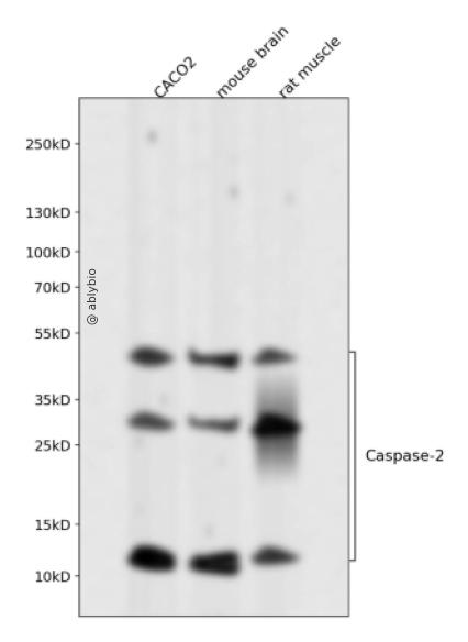 Caspase-2 Rabbit mAb