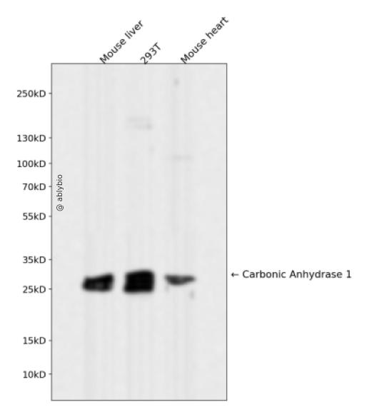 Carbonic Anhydrase 1 Rabbit mAb