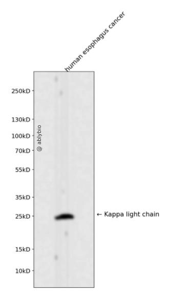 Kappa light chain Rabbit mAb