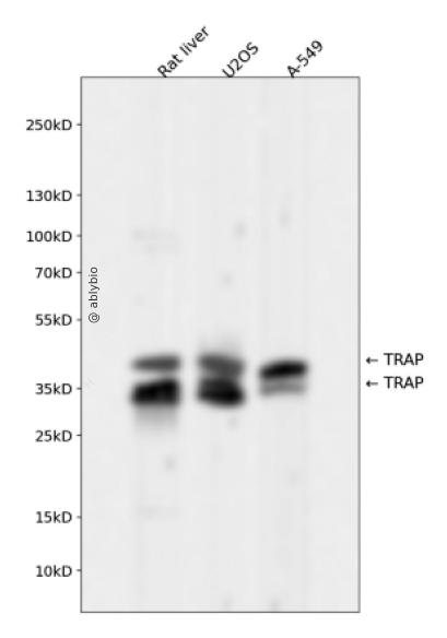 TRAP Rabbit mAb