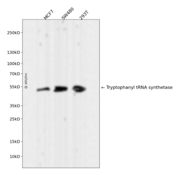 Tryptophanyl tRNA synthetase Rabbit mAb