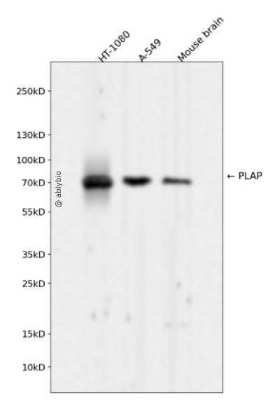 PLAP Rabbit mAb