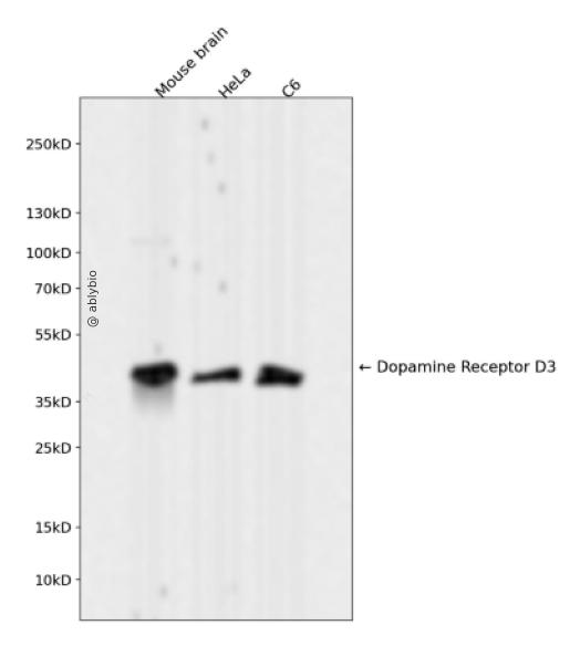 Dopamine Receptor D3 Rabbit mAb