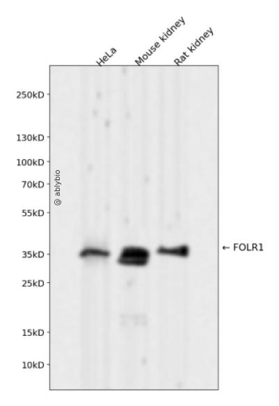 FOLR1 Rabbit mAb