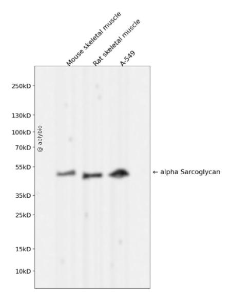 alpha Sarcoglycan Rabbit mAb