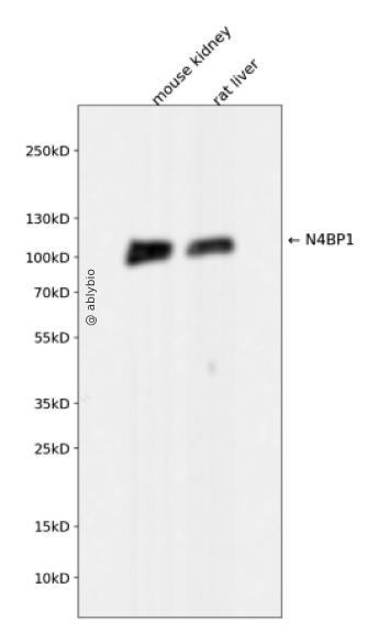 N4BP1 Rabbit mAb