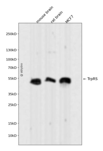 TrpRS Rabbit mAb