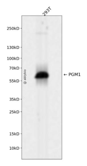 PGM1 Rabbit mAb