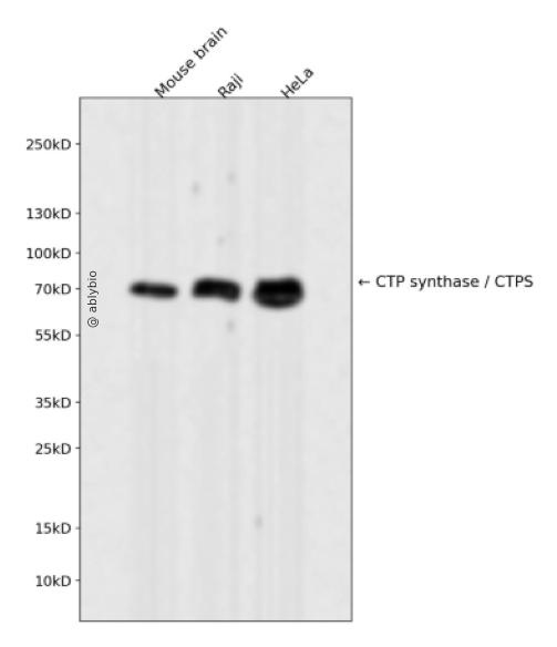 CTP synthase / CTPS Rabbit mAb