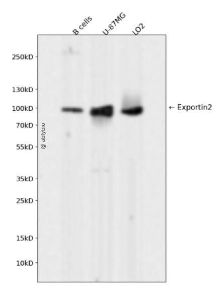 Exportin2 Rabbit mAb