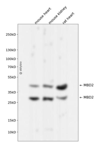 MBD2 Rabbit mAb