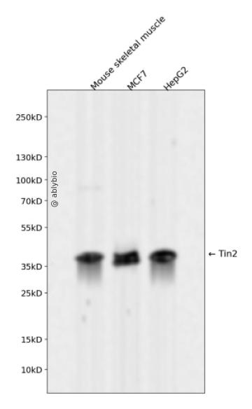 Tin2 Rabbit mAb