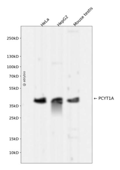 PCYT1A Rabbit mAb