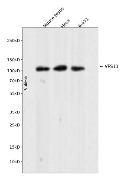 VPS11 Rabbit mAb