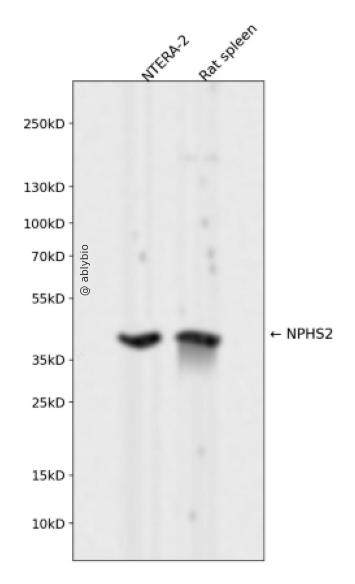 NPHS2 Rabbit mAb