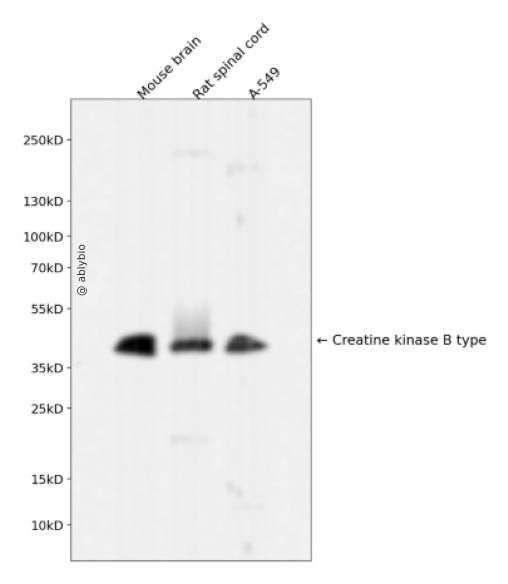 Creatine kinase B type Rabbit mAb