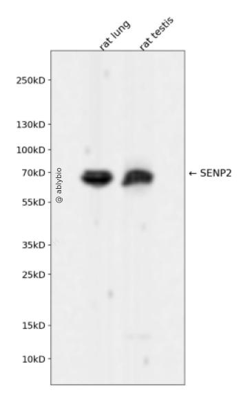 SENP2 Rabbit mAb