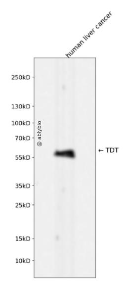 TDT Rabbit mAb