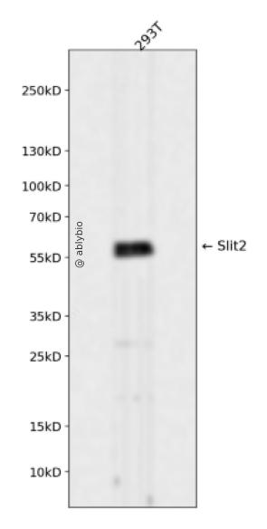 Slit2 Rabbit mAb