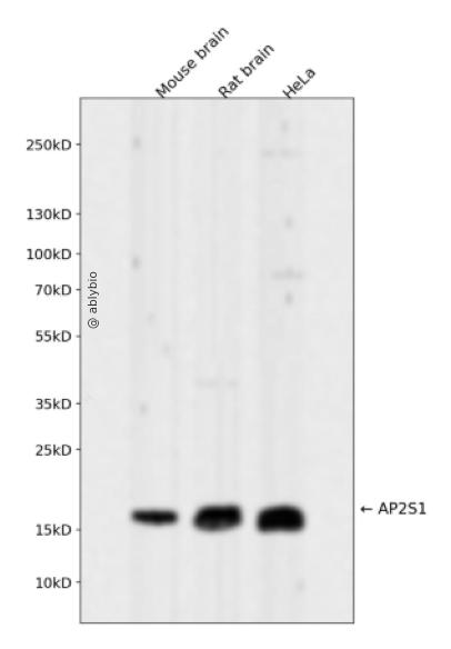 AP2S1 Rabbit mAb