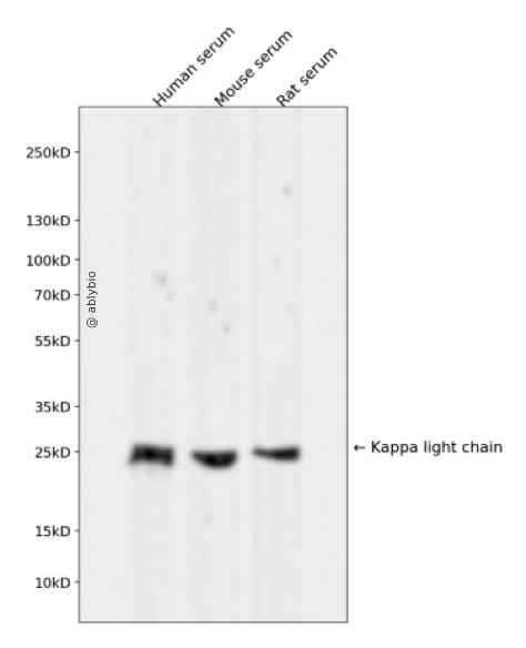 Kappa light chain Rabbit mAb