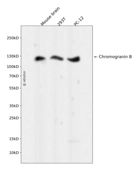 Chromogranin B Rabbit mAb