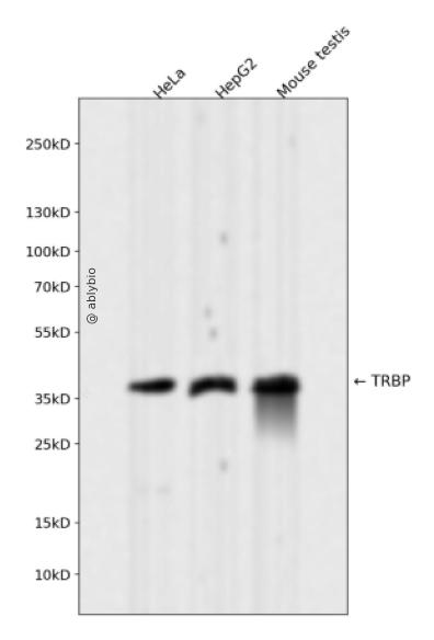 TRBP Rabbit mAb