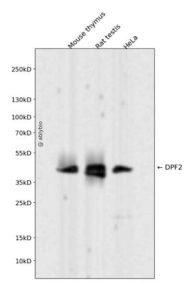 DPF2 Rabbit mAb