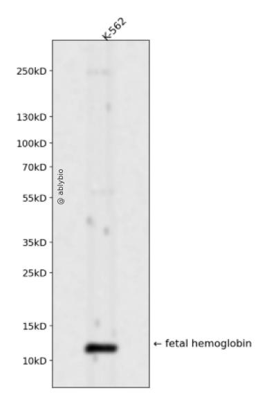 fetal hemoglobin Rabbit mAb