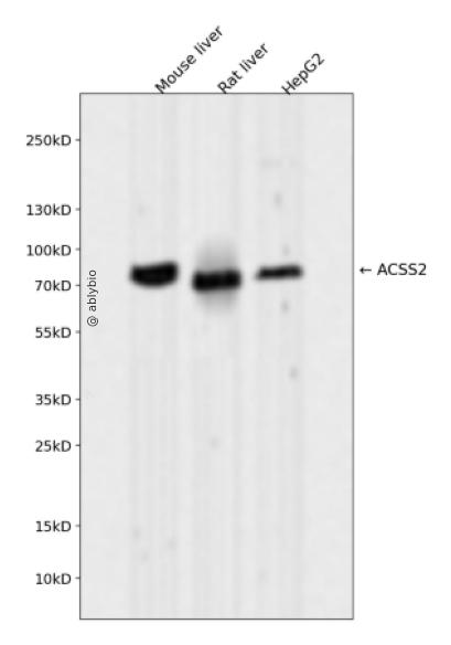 ACSS2 Rabbit mAb