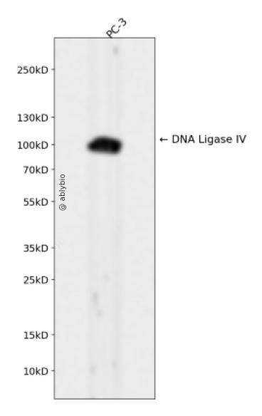 DNA Ligase IV Rabbit mAb