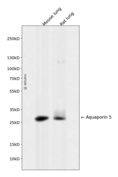 Aquaporin 5 Rabbit mAb