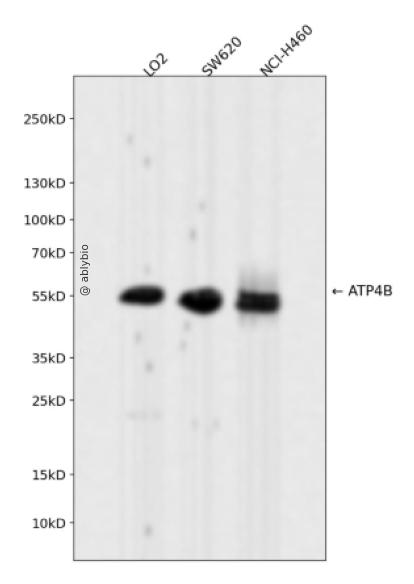 ATP4B Rabbit mAb