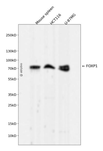 FOXP1 Rabbit mAb