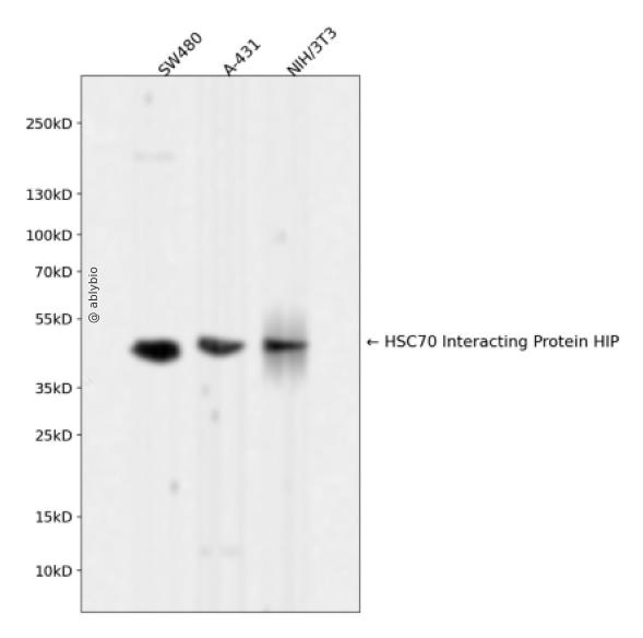 HSC70 Interacting Protein HIP Rabbit mAb