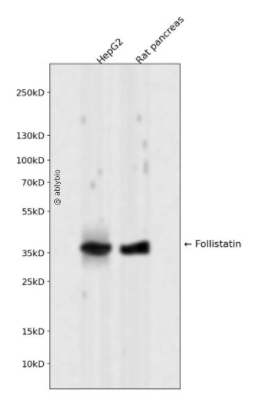 Follistatin Rabbit mAb