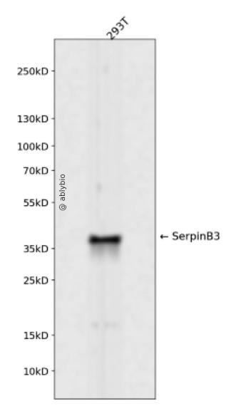 SerpinB3 Rabbit mAb