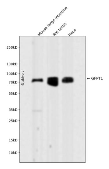 GFPT1 Rabbit mAb