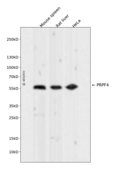 PRPF4 Rabbit mAb